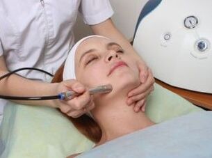 Gesichtslaserverjüngung