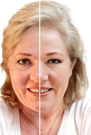 Gesichtsverjüngung