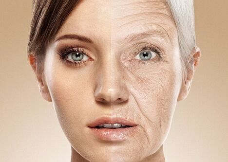 vor und nach der Gesichtshautverjüngung mit Laser